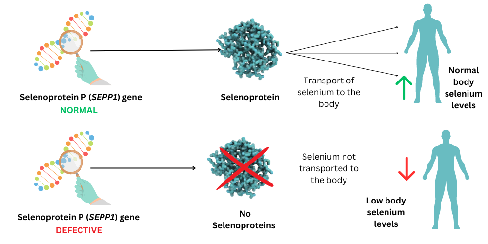 Simple diagram to demonstrate how defective SEPP1 gene can lead to low selenium levels in the body