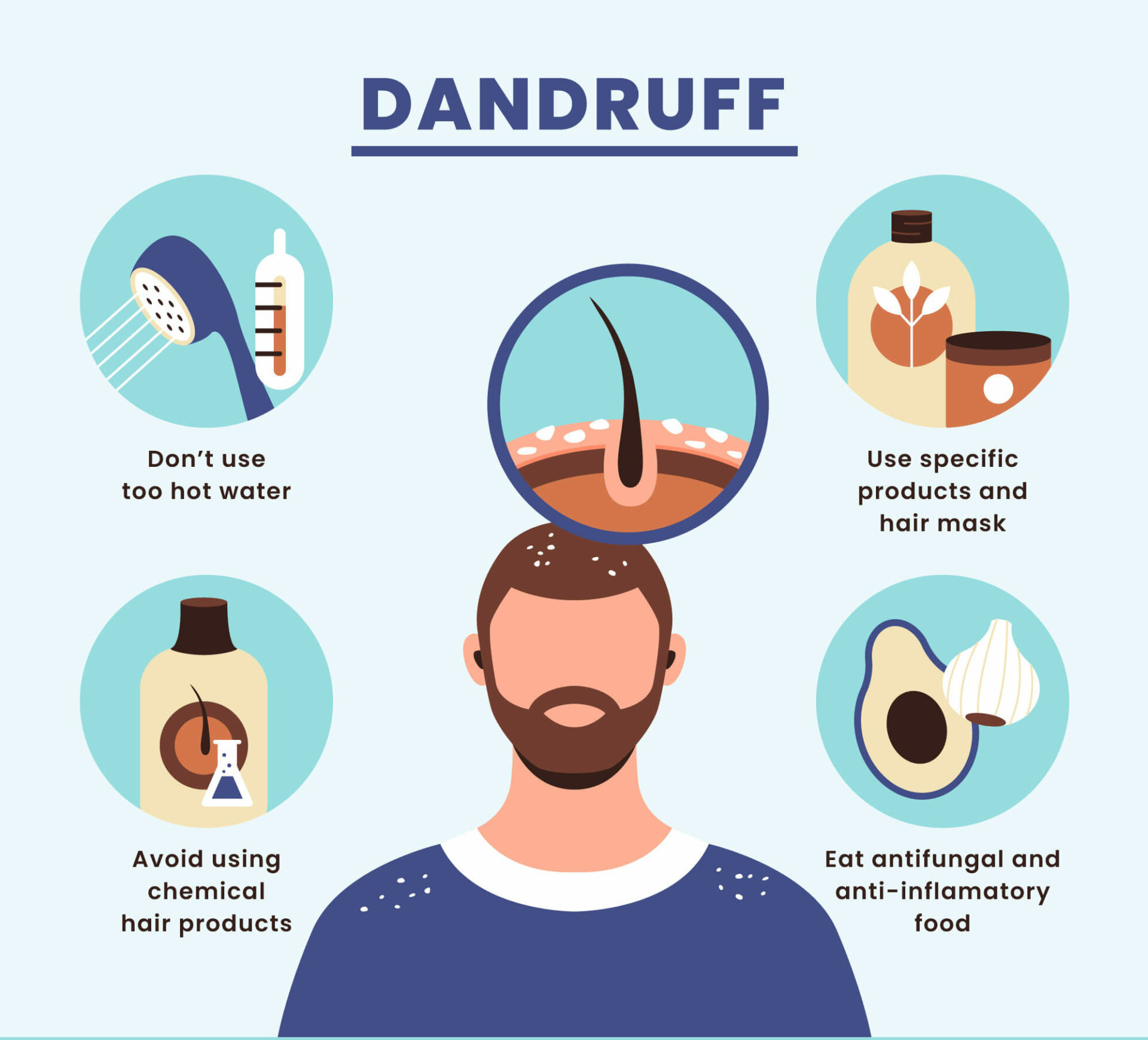 How to manage dandruff?